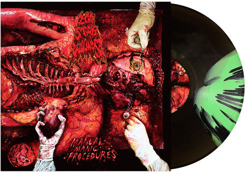 200 Stab Wounds - Manual Manic Procedures [LP - Black Ice/Mint Green Splatter]